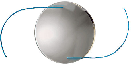 RxSIGHT Light Adjustable Lens